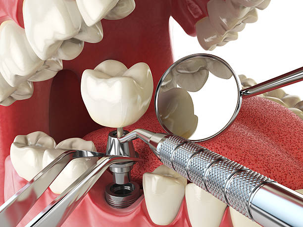 Best Emergency Gum Pain Relief  in Spanish Lake, MO